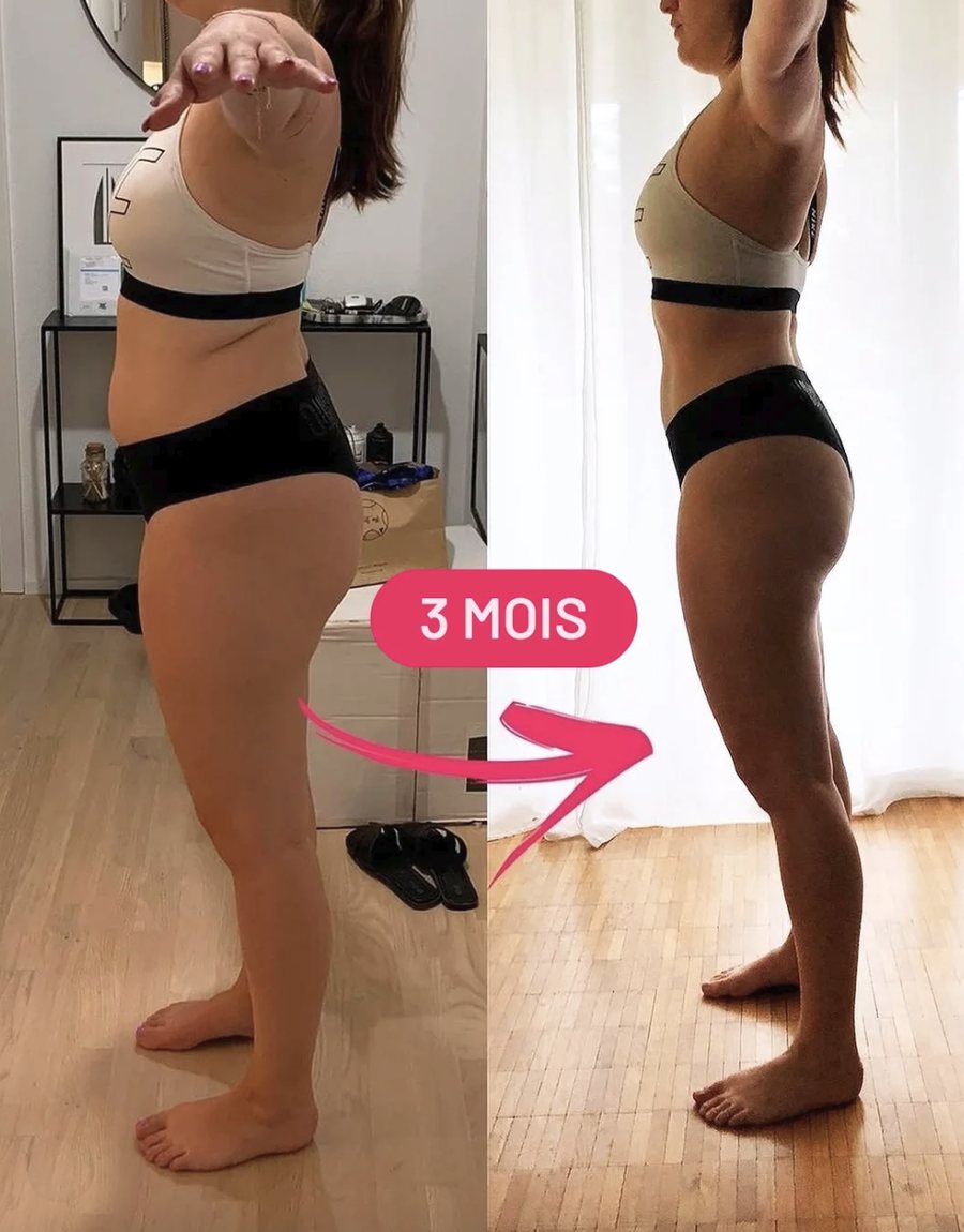 Avant / après de profil montrant l'affinement de la silhouette en 3 mois