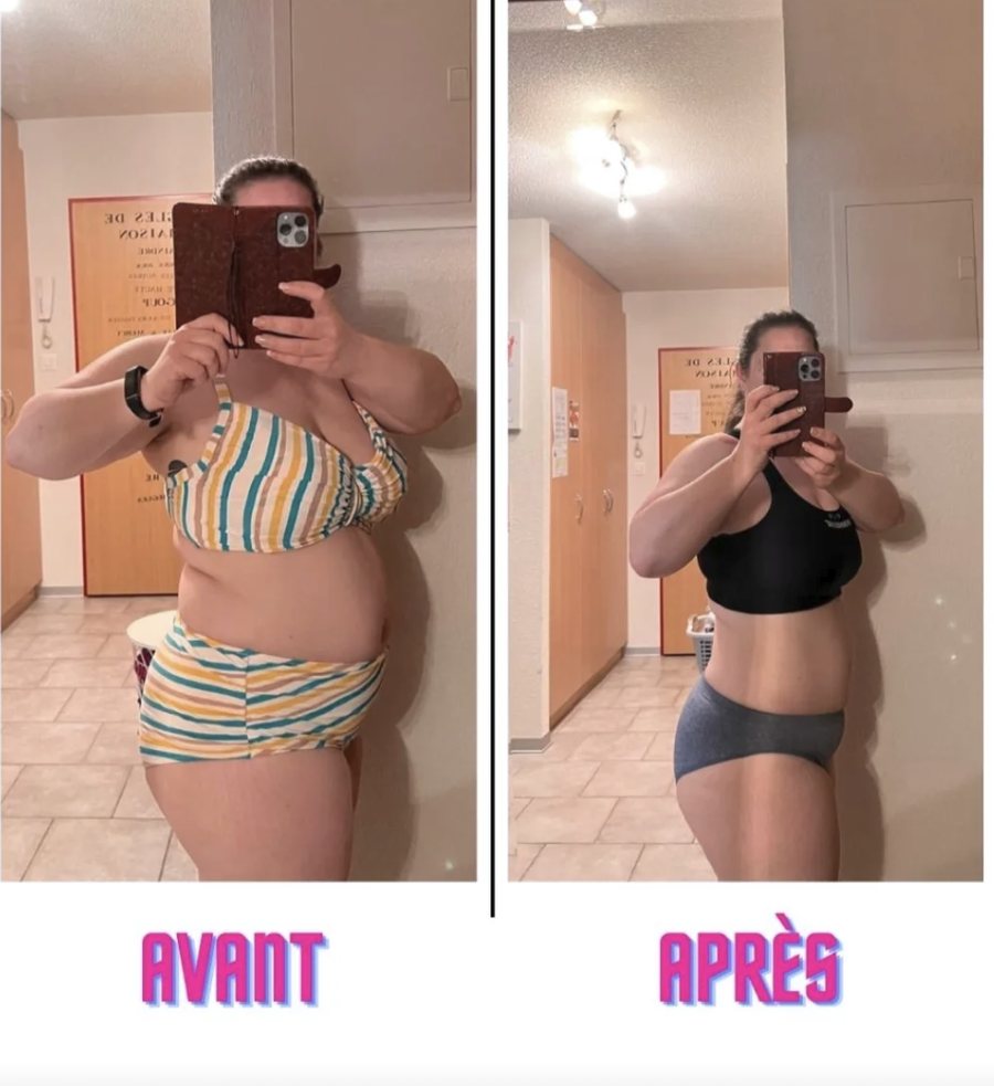 Avant / après des abdominaux après une perte de poids accompagnée par un coach sportif