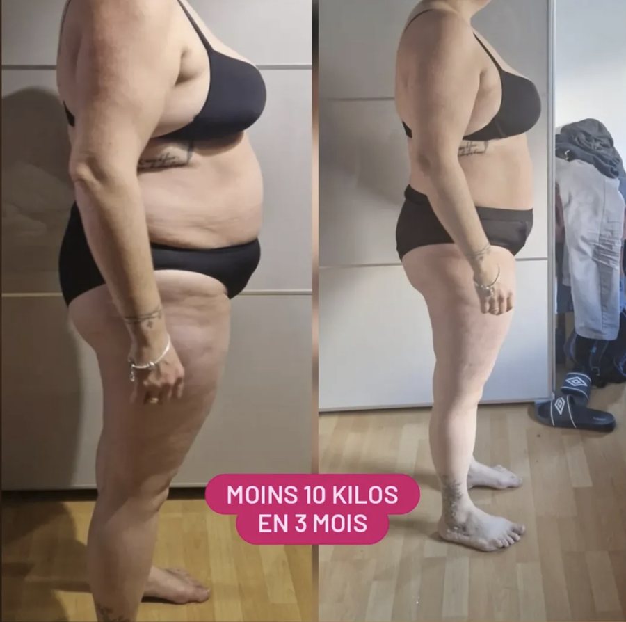 Avant / après de profil d'une cliente ayant perdu 10 kilos en 3 mois à Yverdon-les-Bains