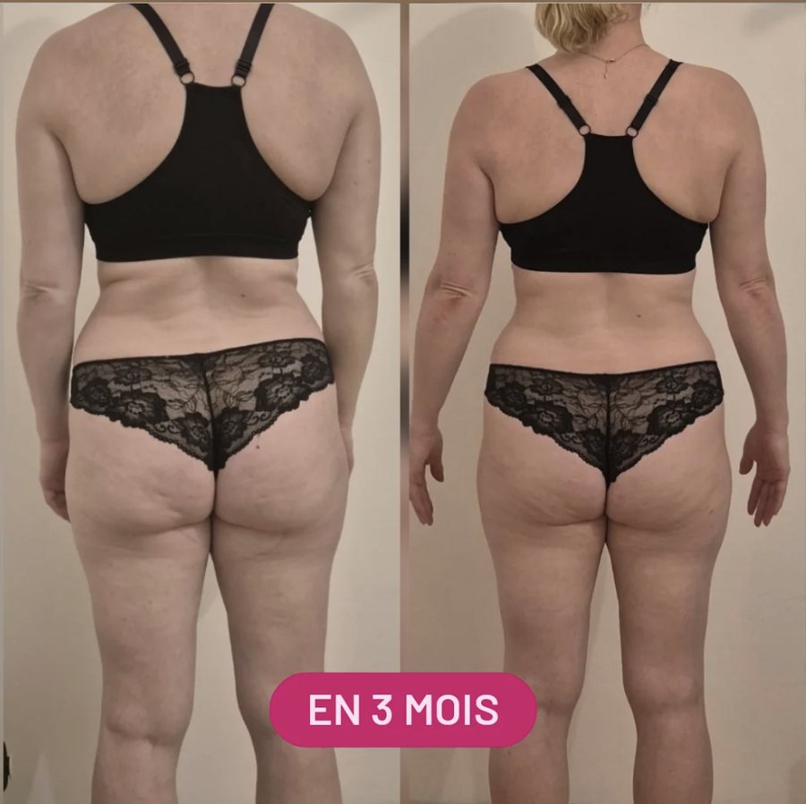 Avant / après du renforcement des fessiers après 3 mois de coaching sportif